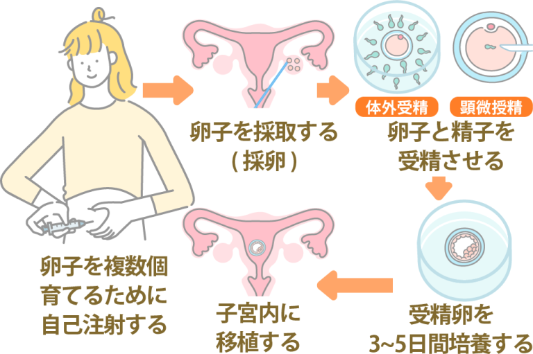 体外受精(IVF)や顕微授精(ICSI)の胚移植は毎月できる?頻度と妊娠率を解説 | にしたんARTクリニック