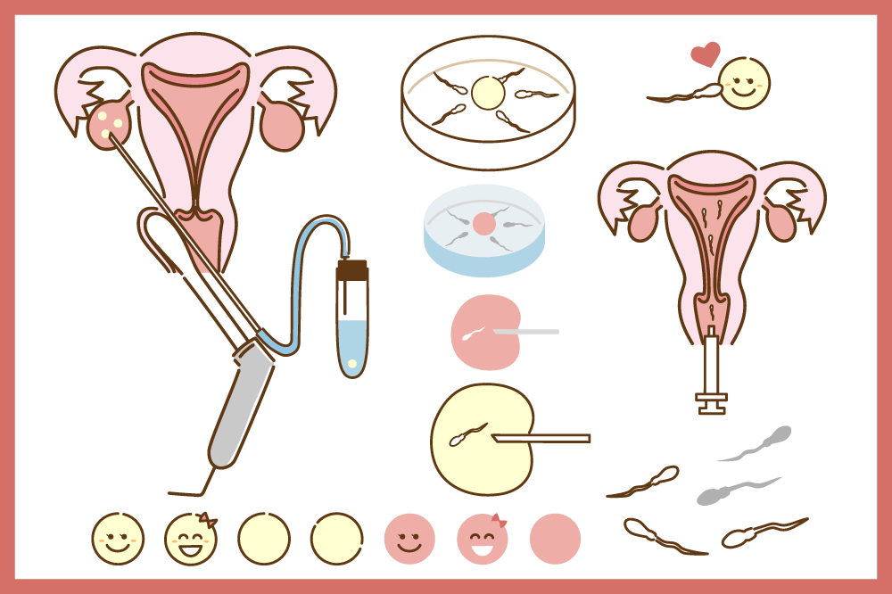 人工授精(AIH)と体外受精(C-IVF)の違いとは?不妊治療の流れを解説