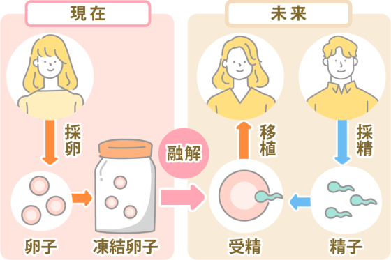 にしたんARTクリニック京都院の卵子凍結特集